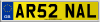 AR52 NAL